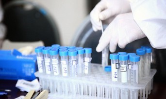  Nhiều đơn vị chống dịch trên cả nước đã sử dụng sản phẩm kit xét nghiệm Covid-19 RT-PCR do Công ty TNHH Thiết bị B.D.E cung cấp. Ảnh minh họa: Tiên Giang